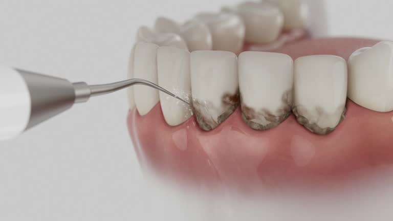 Trusted Teeth Whitening service in Bridgeport, MI - Dentist Open Now